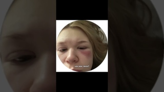 Я СОБРАЛА САМЫЕ СТРАННЫЕ АЛЛЕРГИИ 😅 #аллергии #болезни #топ