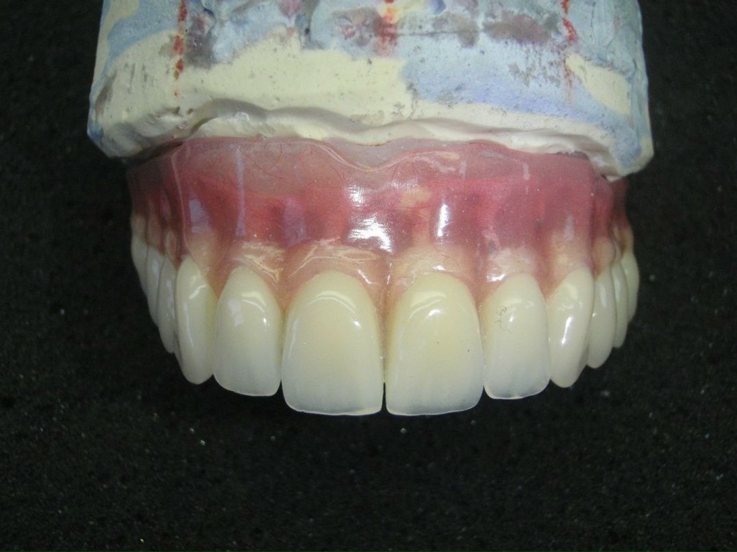 Эрнест Абрамян | Москва