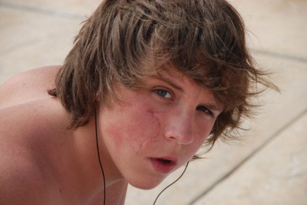 Лешка Чикун | Москва