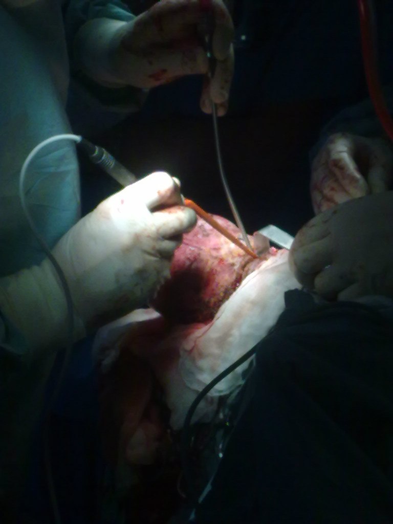 Эльгюн Мамедов | Москва