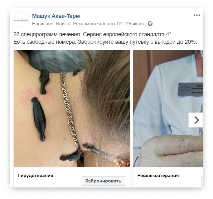 С нуля до 90 заявок в месяц со средним чеком 100 000 ₽. Как превратить Instagram в надёжный канал привлечения?, изображение №10
